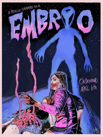 Embrión