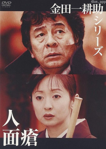 金田一耕助:人面疮