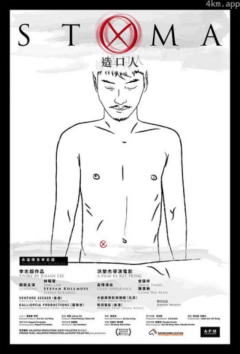 造口人